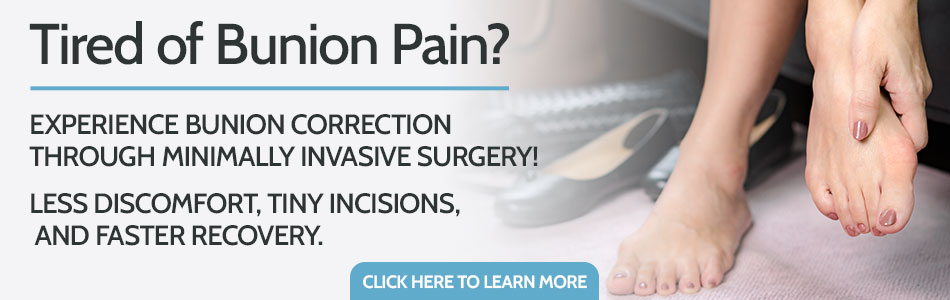 Minimally Invasive Surgery for Bunions