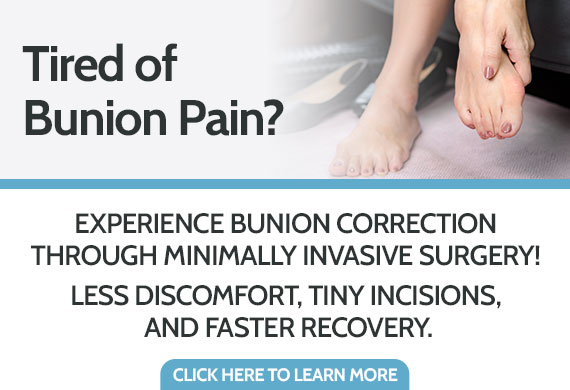 Minimally Invasive Surgery for Bunions