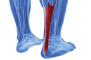Achilles tendonitis treatment in the Queens County, NY: Flushing (College Point, Whitestone, Elmhurst, Jackson Heights, Jamaica, Forest Hills, Astoria, Corona), Nassau County, NY: Elmont, Floral Park, Great Neck, Lake Success and Bergen County, NJ: Fort Lee (Englewood, Tenafly, Teaneck, Teterboro, Hackensack, Bergenfield, East Rutherford, Paramus), Hudson County, NJ: Secaucus, Hoboken areas